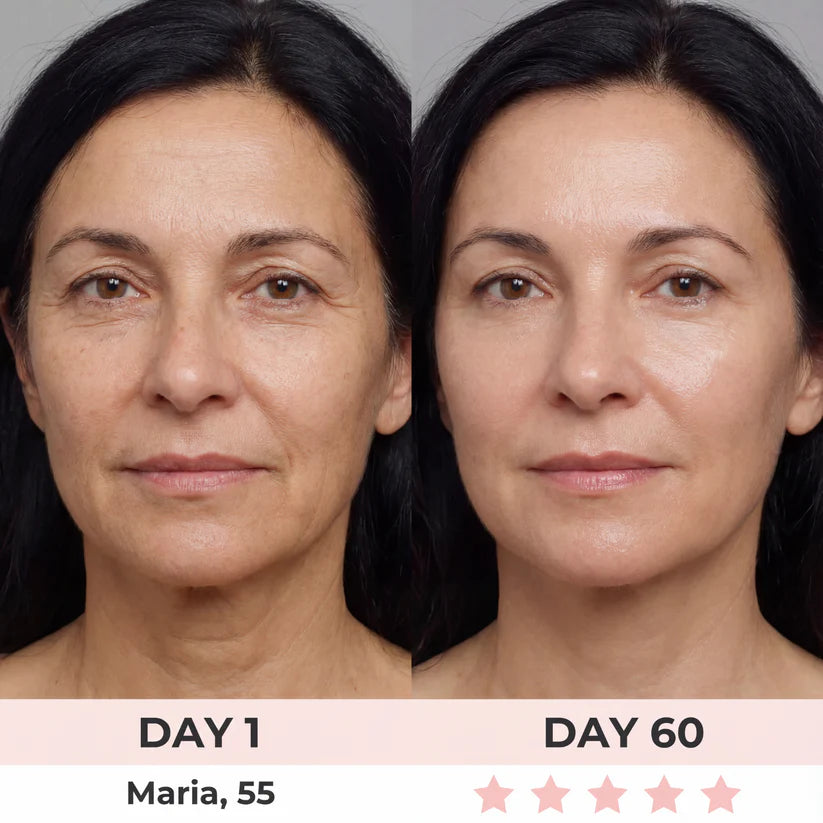 MINERVA 4-en-1 Sculpteur Visage LED