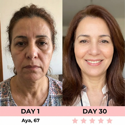 MINERVA 4-en-1 Sculpteur Visage LED